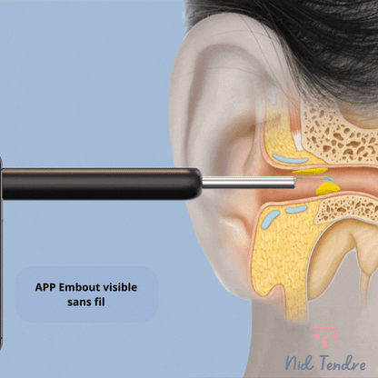 Nettoyant Oreille Otoscope,  Camera Oreille D'élimination Du Cérumen  |  EarexPro™