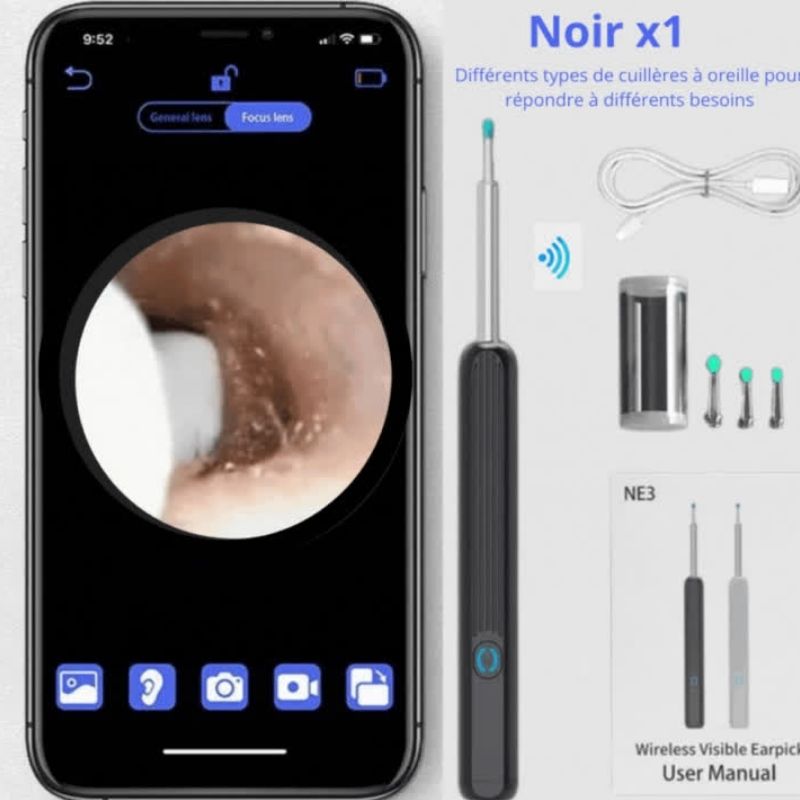 Nettoyant Oreille Otoscope,  Camera Oreille D'élimination Du Cérumen  |  EarexPro™