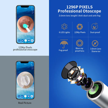 Nettoyant Oreille Otoscope,  Camera Oreille D'élimination Du Cérumen  |  EarexPro™