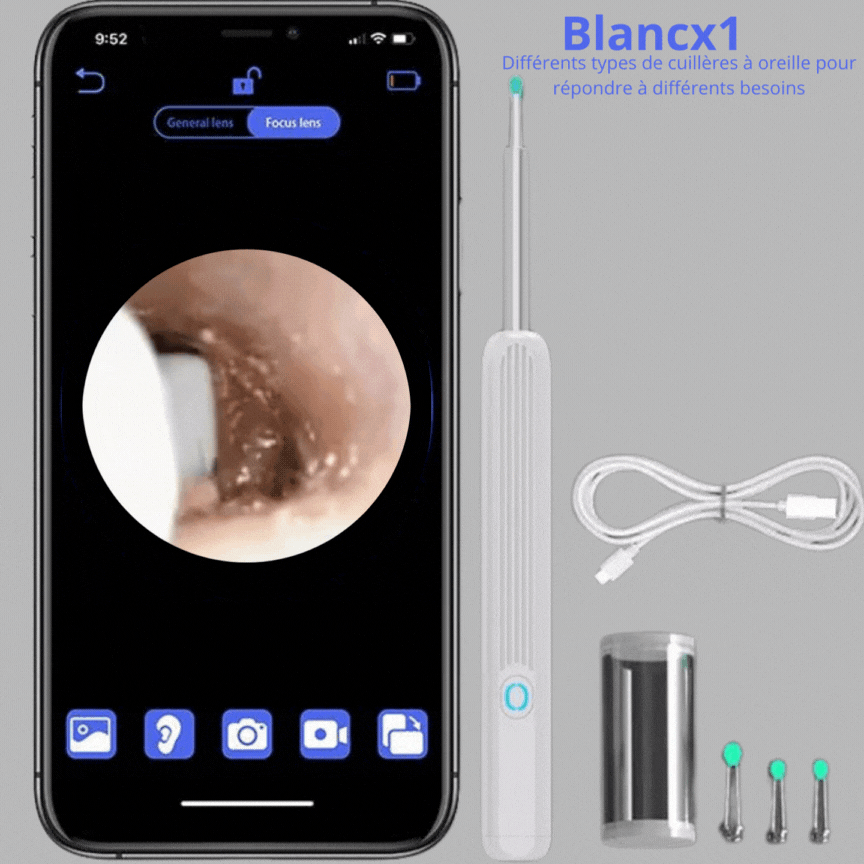 Nettoyant Oreille Otoscope,  Camera Oreille D'élimination Du Cérumen  |  EarexPro™